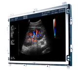 15'' open frame ultrasound medical display color monitor