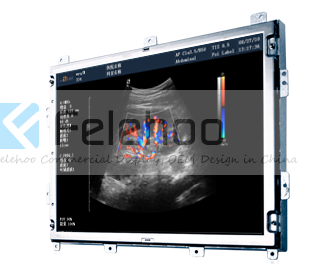 15'' open frame ultrasound medical display color monitor
