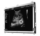 20.8inch open frame ultrasound Monochrome Monitor