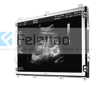 20.8inch open frame ultrasound Monochrome Monitor